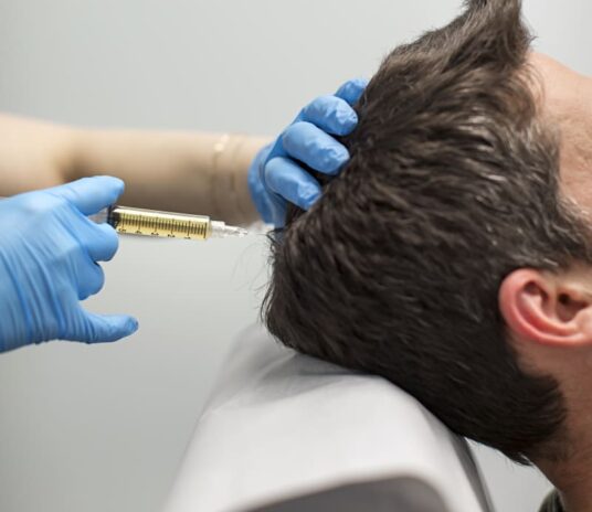 claraderma-prp-hair-loss