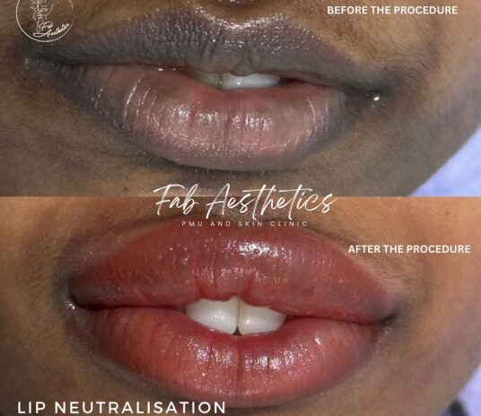 520822696_17940257397030840_6223967510351197740_n