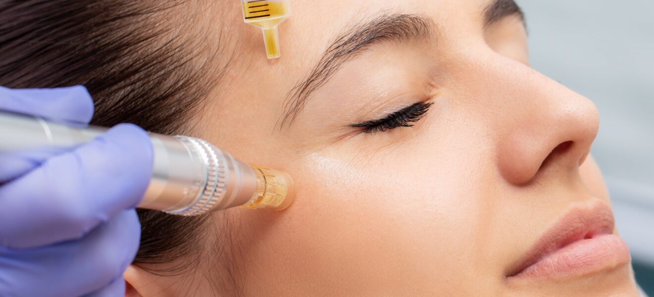 Dr-K-Beauty-Dr.-Khronusova-Las-Vegas-NV-Mesofacial-Treatment-Your-Top-Questions-Answered-scaled