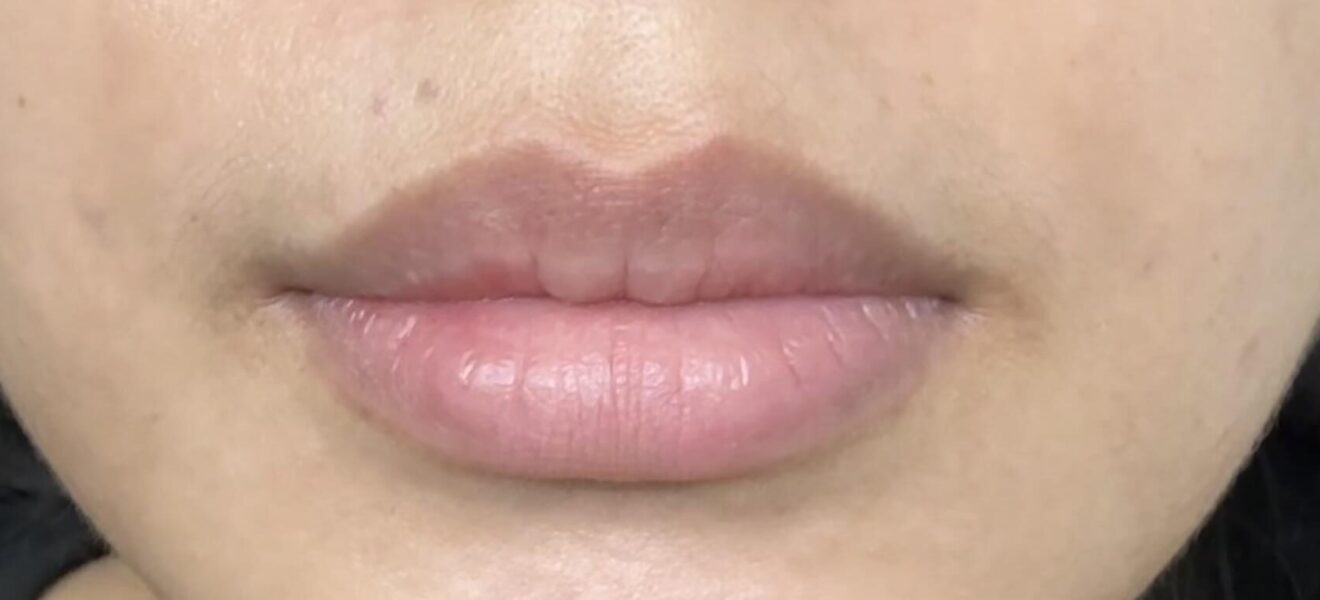 lip-neutralization-freak-out-moment-v0-zr6lf45xixqe1