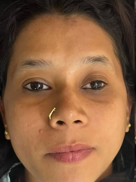 Before Microblading