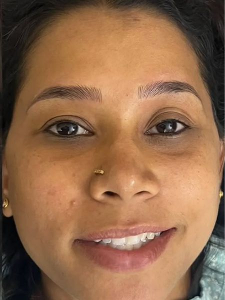 After Microblading