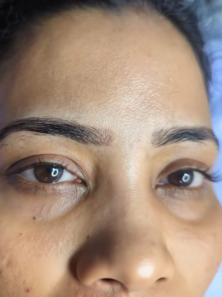 Before Microblading