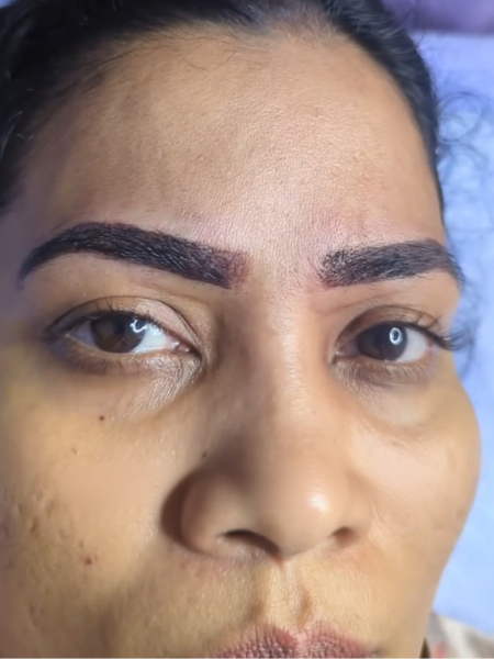 After Microblading