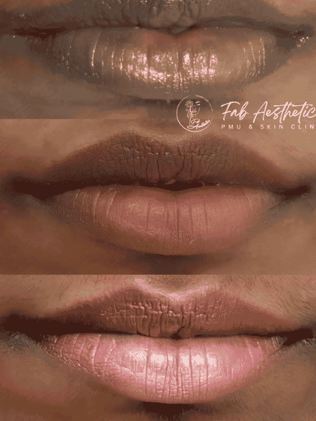 Lip Neutralization