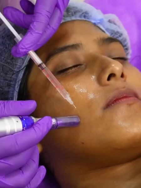 During Treatment